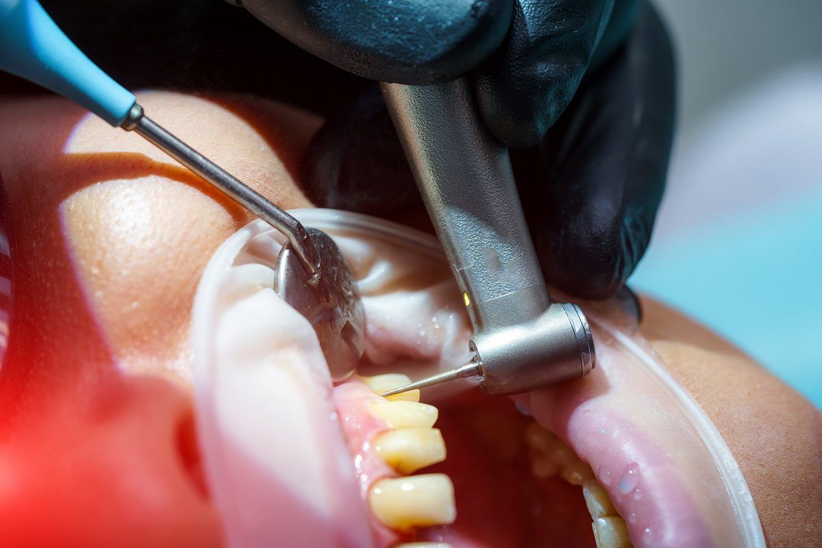 Dental Sugery