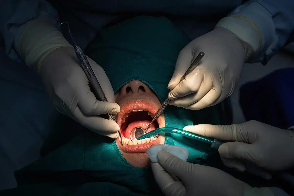 Reasons you may need Dental Bone Graft Surgery.