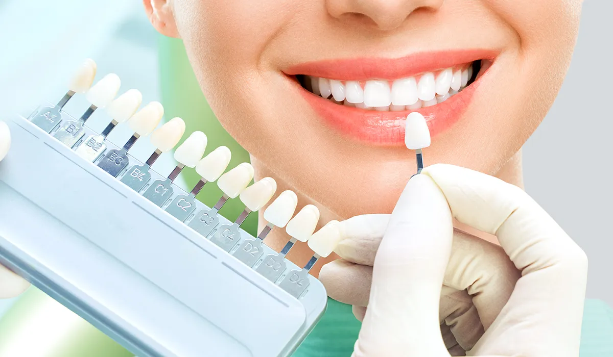Dental Veneers vs. Other Cosmetic Dental Treatments: Which is Right for You? 