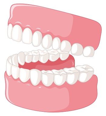 Dental Crowns and Veneers