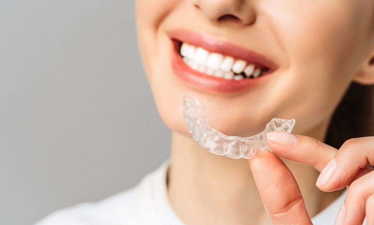 Invisalign Attachments: What You Need to Know.